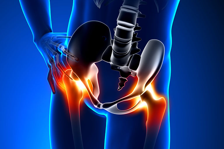 Radiofrequency Nerve Ablation – IPSSC